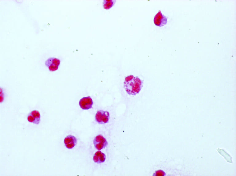 目で見る病原体 ②髄膜炎菌
