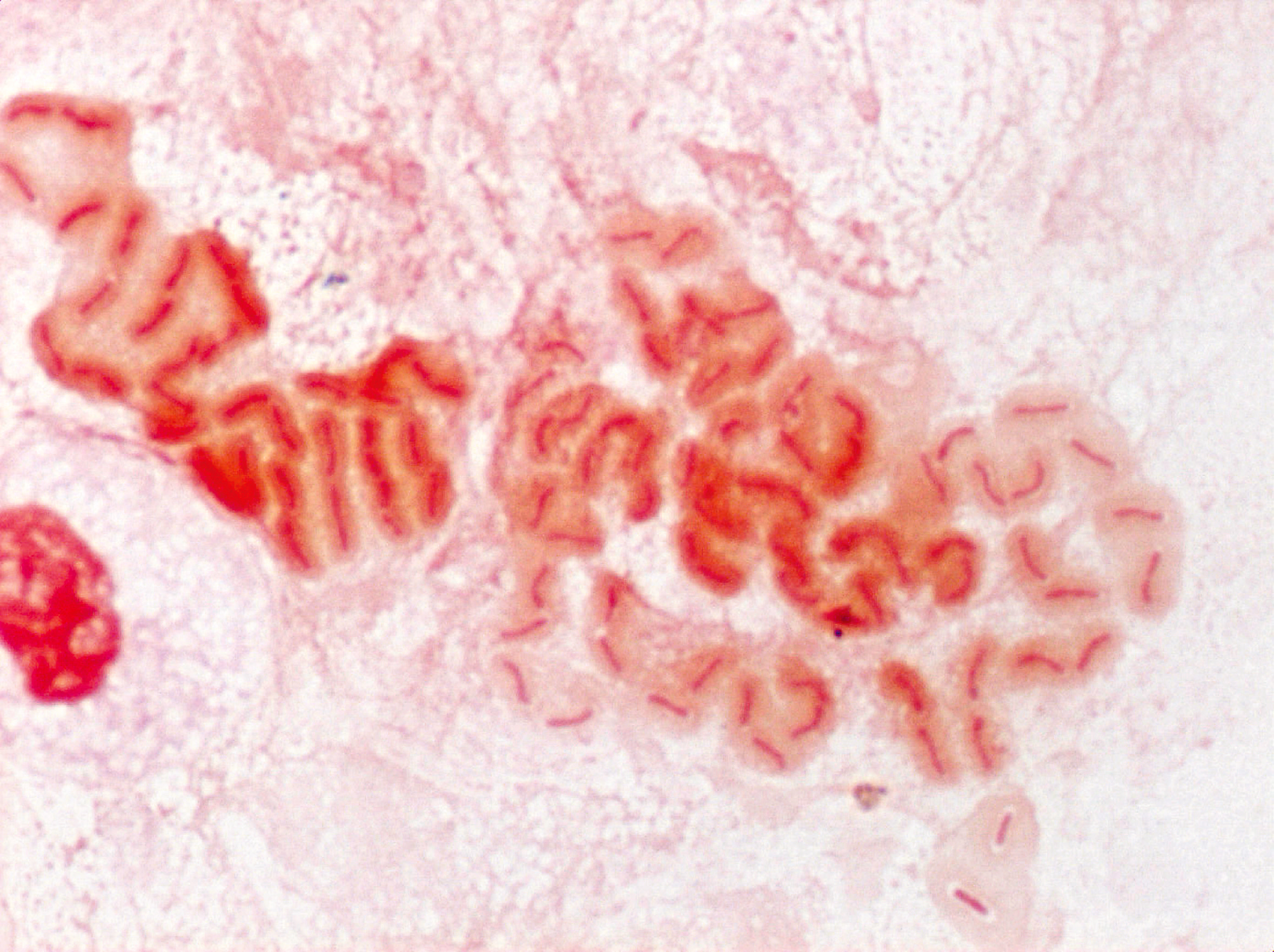 目で見る病原体 緑膿菌 感染対策online